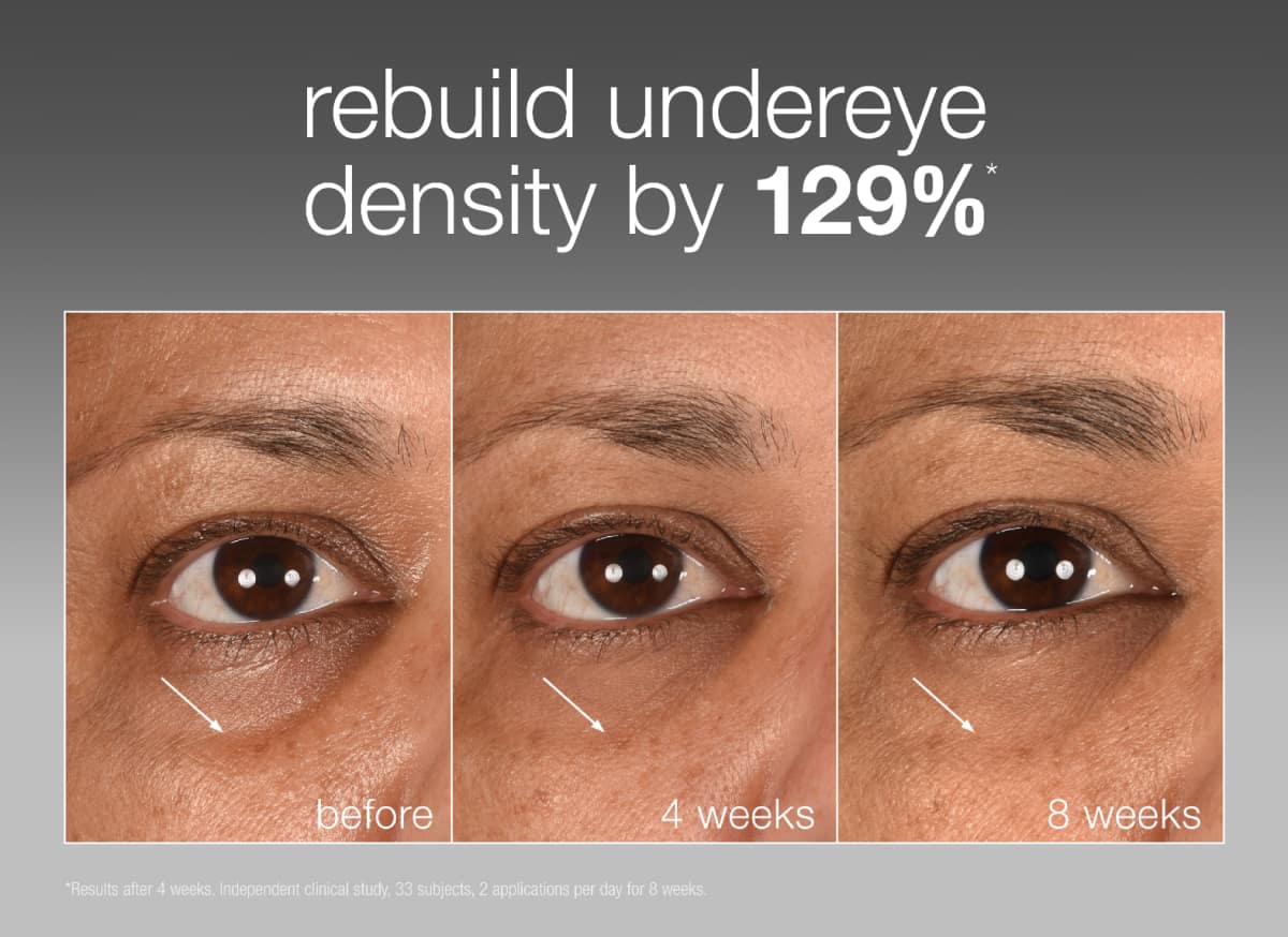 NEW Smart Eye Density