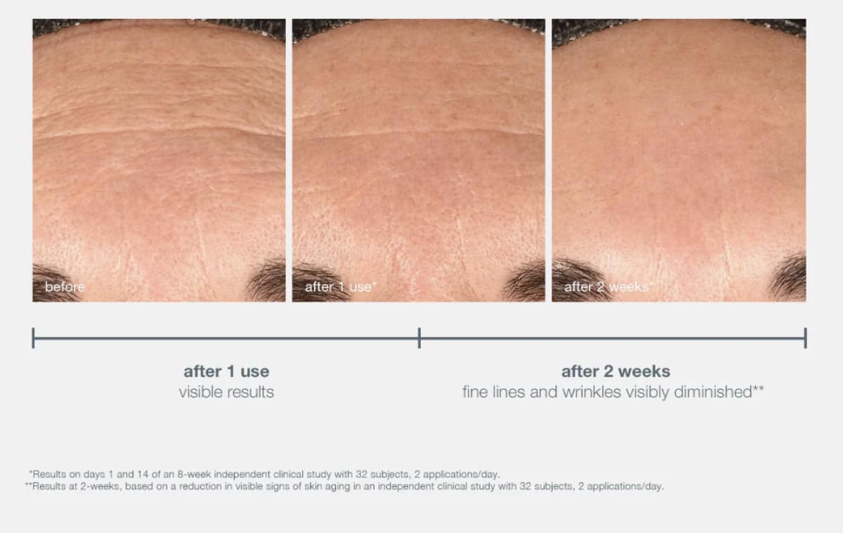 phyto nature e² regenerating daily exosome leave-on treatment