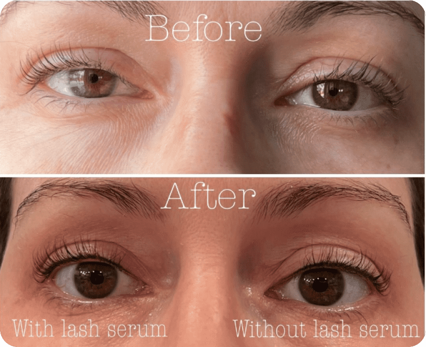 Before and After Results of Lash Serum