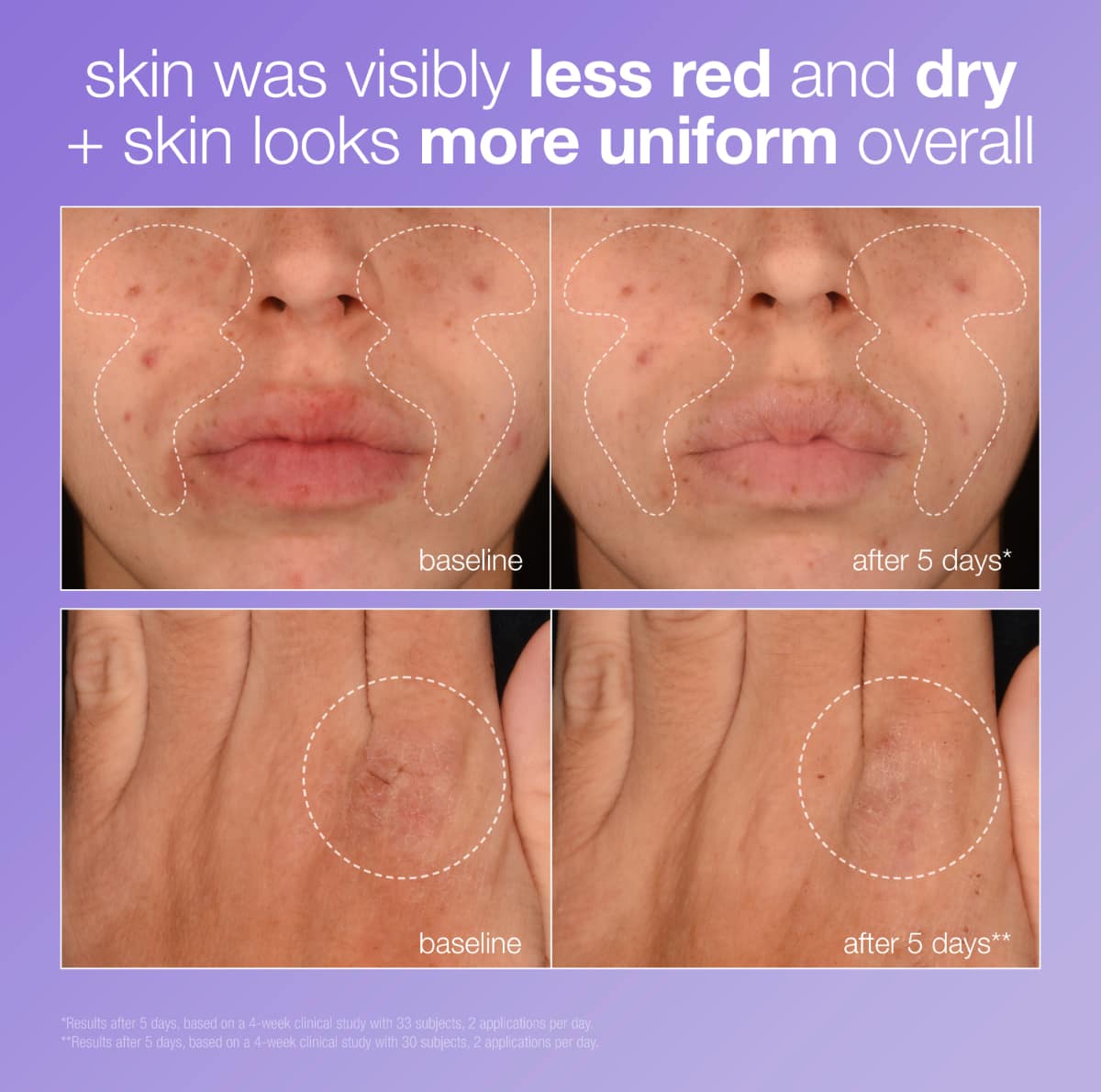 stabilizing repair serum