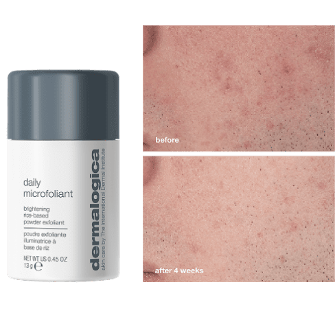 Dermalogica Advent Calendar