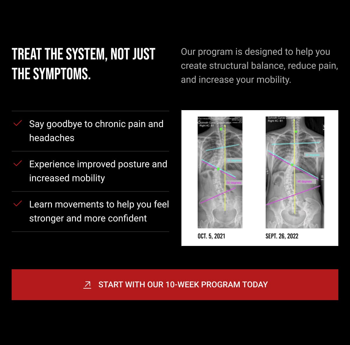 Transform Your Movement Improve Scoliosis Functional Patterns