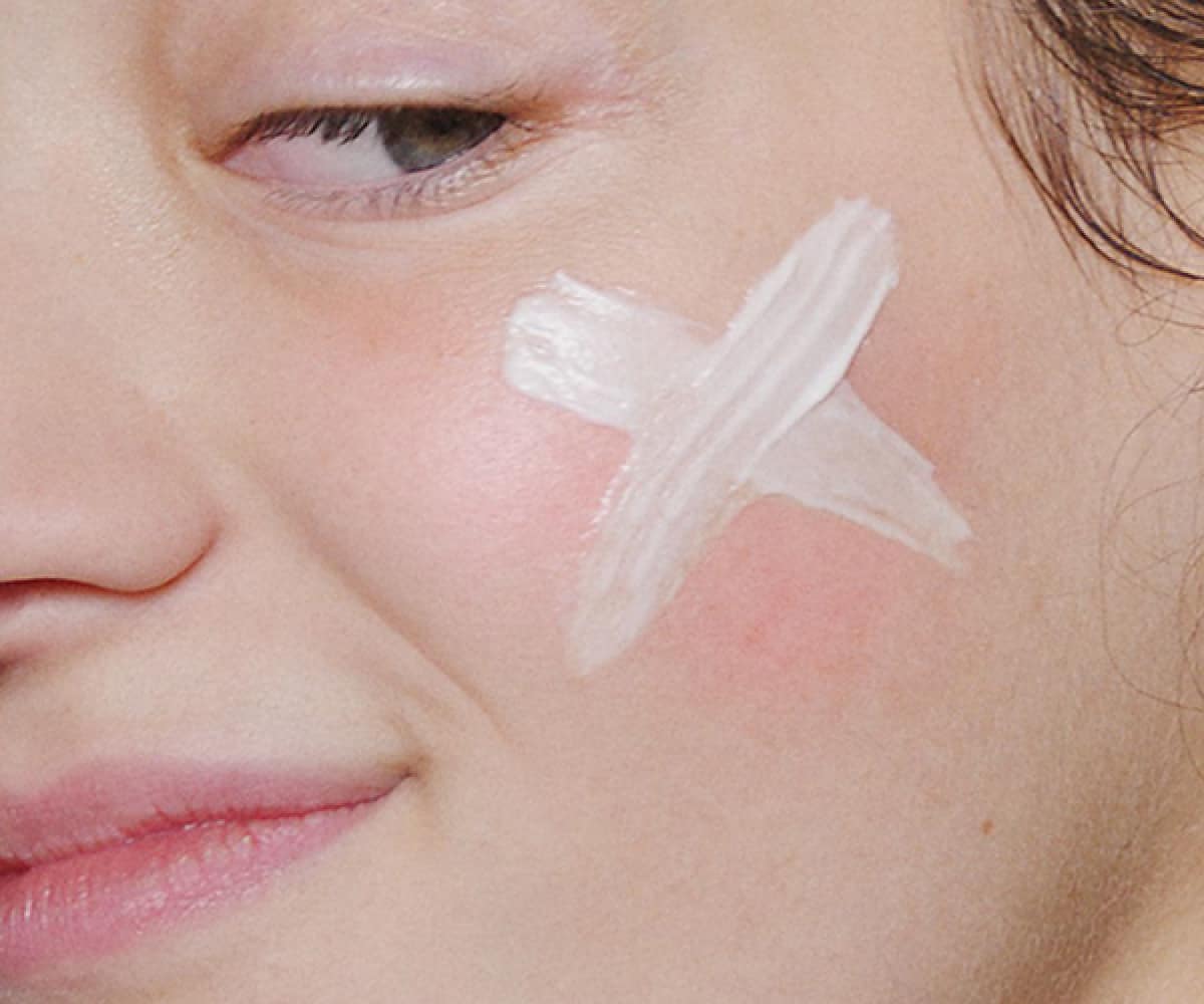 Eczema - Triggers, Symptoms, And Management