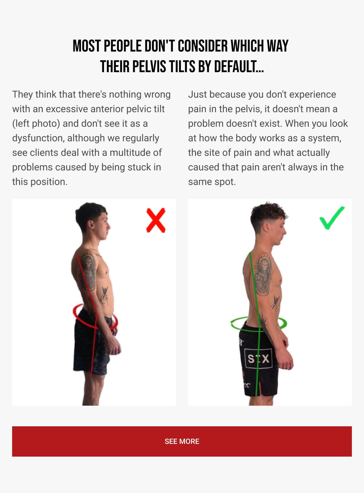 Do Pelvic Tilts Matter? 🤔 Functional Patterns