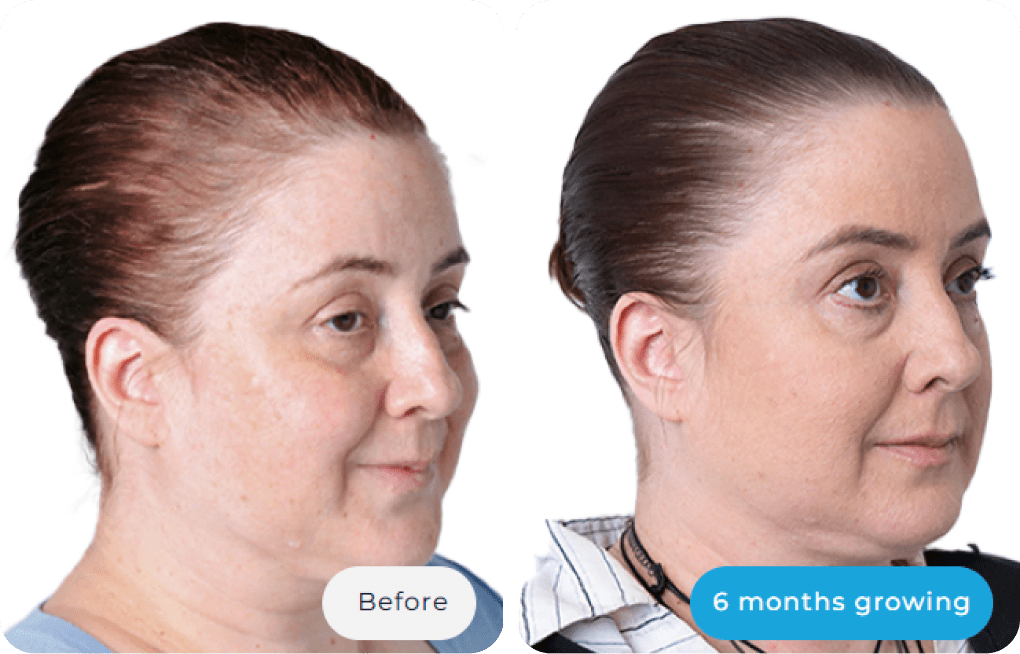 Before and after image