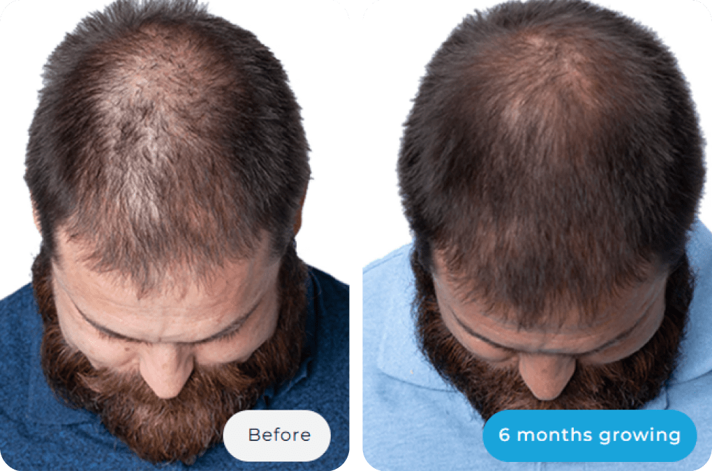 Before and after image