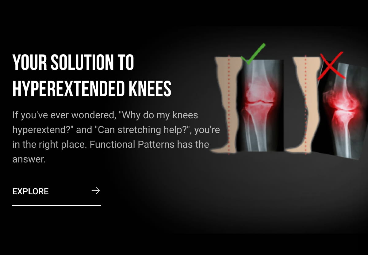 Hyperextended Knees? We have a fix! - Functional Patterns